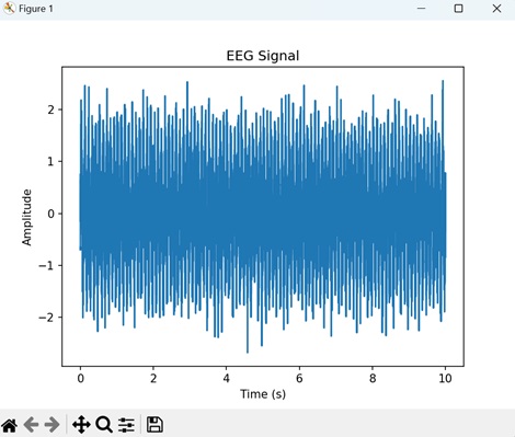 mri with eeg2