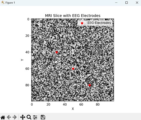 mri with eeg3